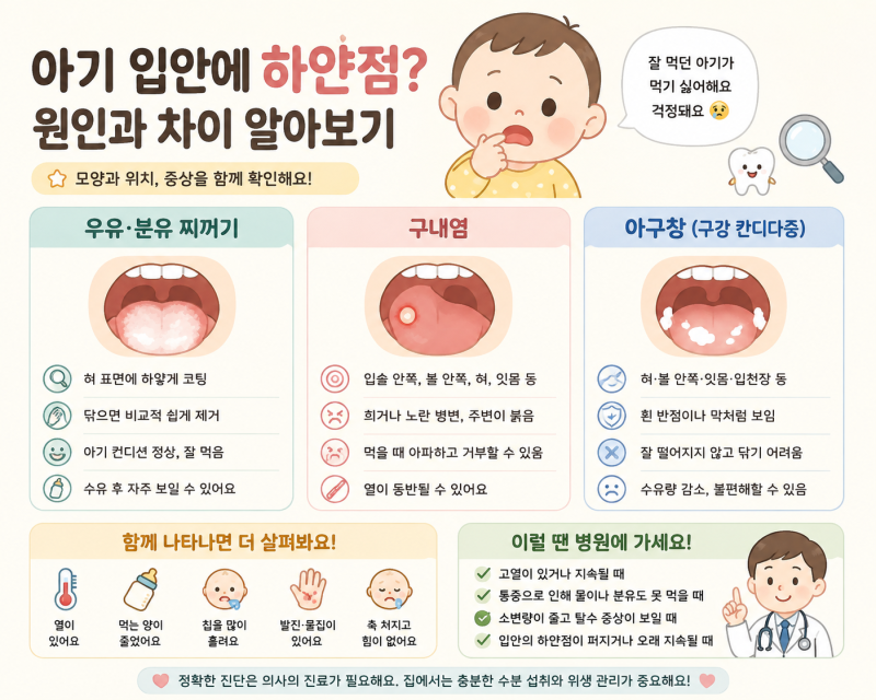 아기 입안에 하얀점 생겼어요? 구내염·아구창·우유 찌꺼기 차이와 병원 가야 하는 기준