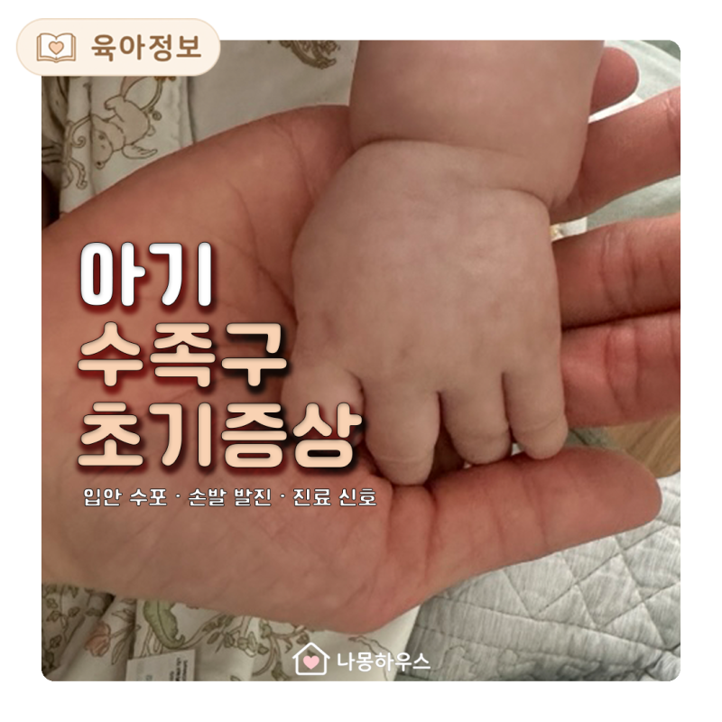 아기 수족구 초기증상, 입안 수포·발진·열이 날 때 확인법