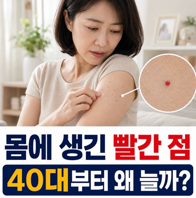 몸에 빨간 점 왜 생길까? 체리혈관종??