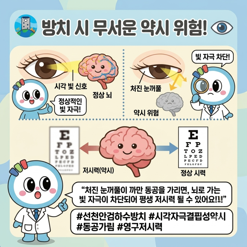 안검하수를 방치하면 안 되는 의학적 이유: 시야 차단, 약시 유발과 목 뼈 변형까지?! ⚠️️
