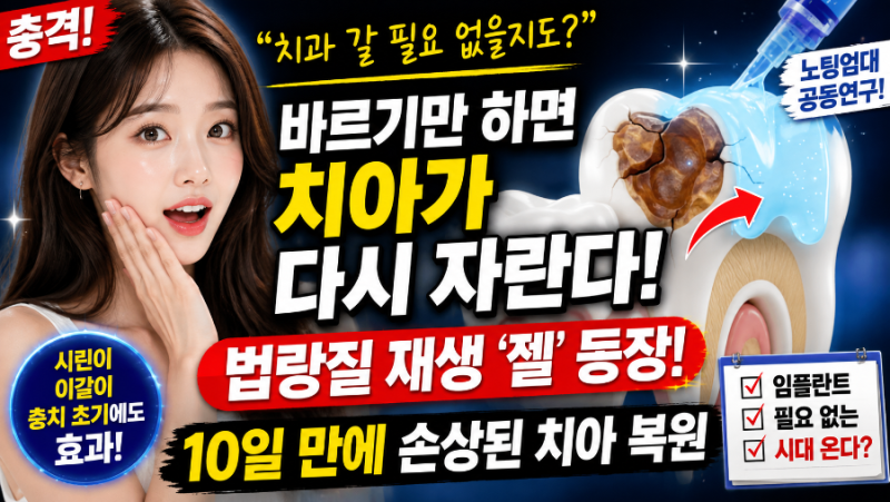 “치약처럼 바르면 치아가 다시 자란다?” 법랑질 재생 젤 등장에 난리…“임플란트도 사라....