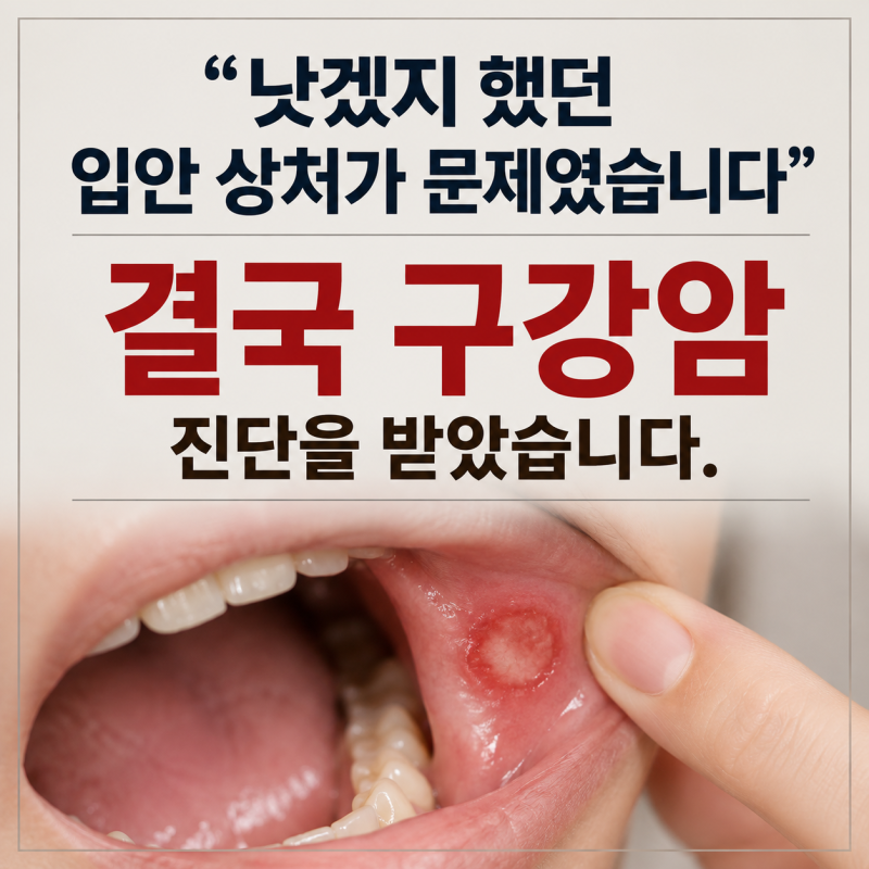 "낫겠지 했던 입안 상처가 문제였습니다" 결국 구강암 진단을 받았습니다.