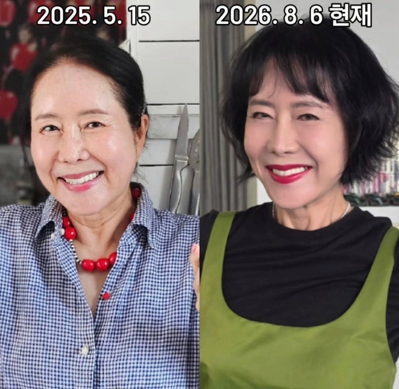 63세 윤영미, 안면거상 후 확 달라진 얼굴…도대체 뭘 했길래?