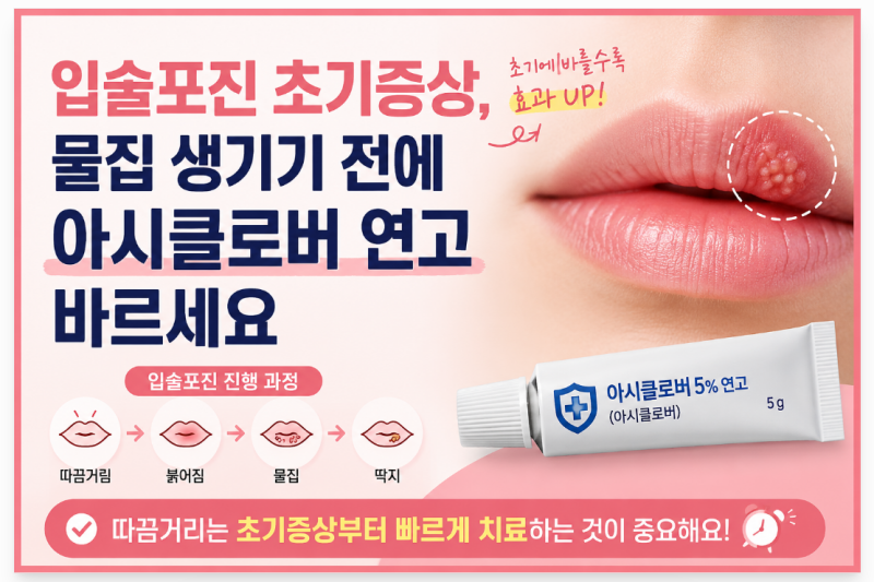 입술포진 헤르페스 초기증상, 입술 물집 생기기 전에 아시클로버 연고 바르세요.