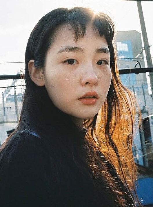 "전현무도 진땀 빼게 한 김민하 주근깨" 어릴때 부터 안 없앤 진짜 이유
