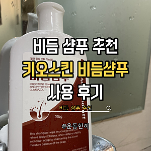 비듬샴푸 추천 키오스킨비듬샴푸 직접 사용해본 후기