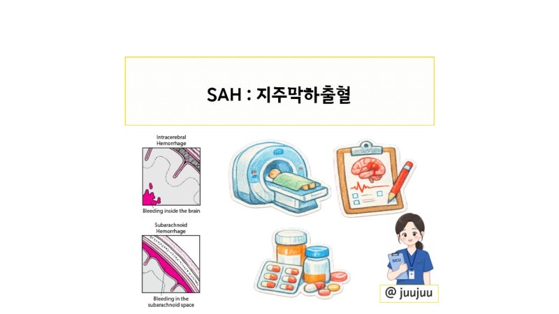 SAH (지주막하출혈) 핵심 요약: nimodipine·vasospasm·치료·예방