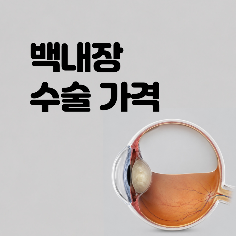 백내장 수술 가격 차이 나는 이유? 렌즈 선택 전 필수 체크