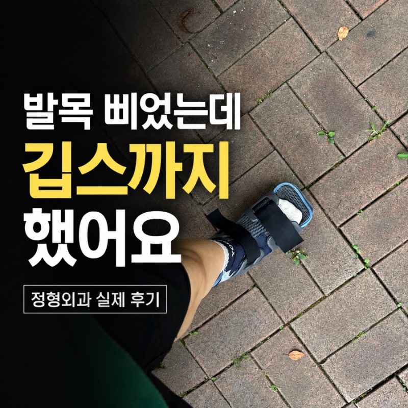 발목 삐었을 때 정형외과 후기｜X-ray 검사부터 인대 손상, 깁스·물리치료까지