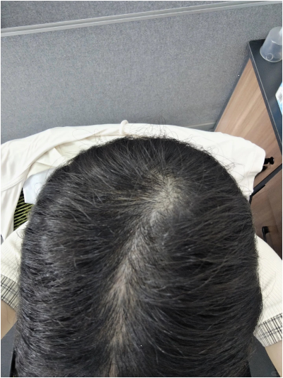 도브샴푸바 두 달 써보고 솔직하게 적는 후기, 결국 다른 걸로 갈아탔다