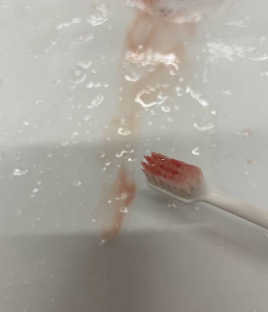 잇몸에좋은영양제 3개월 먹고 제가 깨달은 것