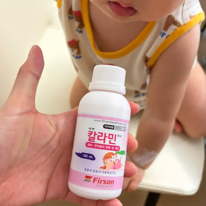 칼라민 연고, 수족구 때 발라도 될까요? 주의점