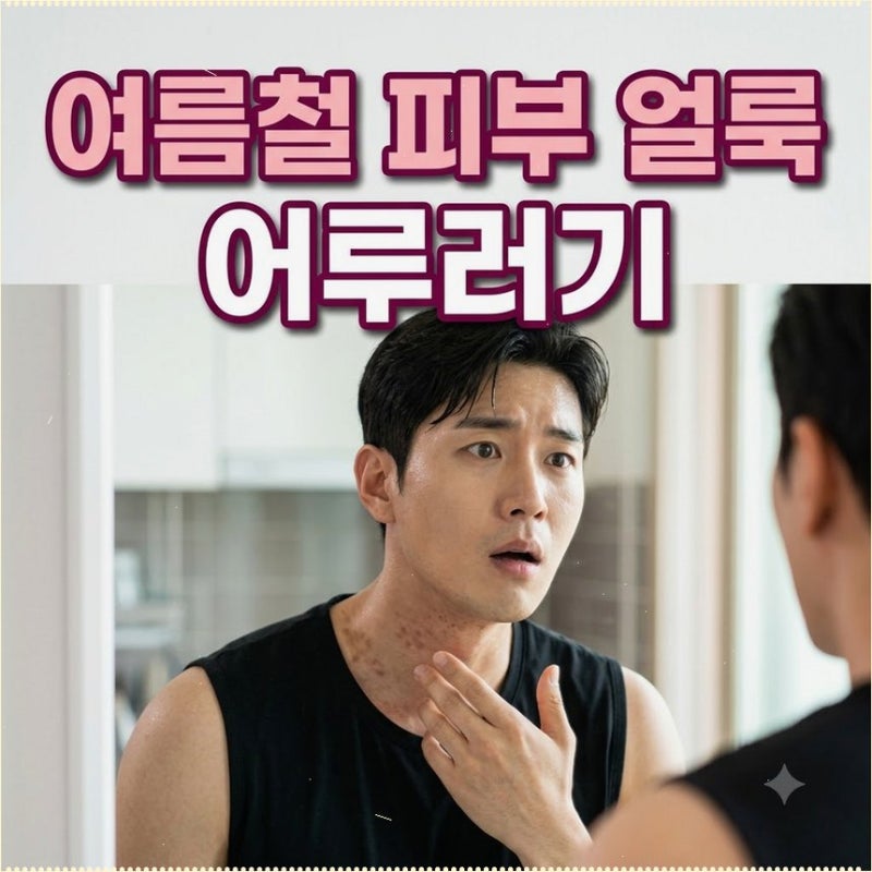 여름철 피부 얼룩 어루러기 원인과 증상 치료법 항진균제 연고 바르게 쓰기