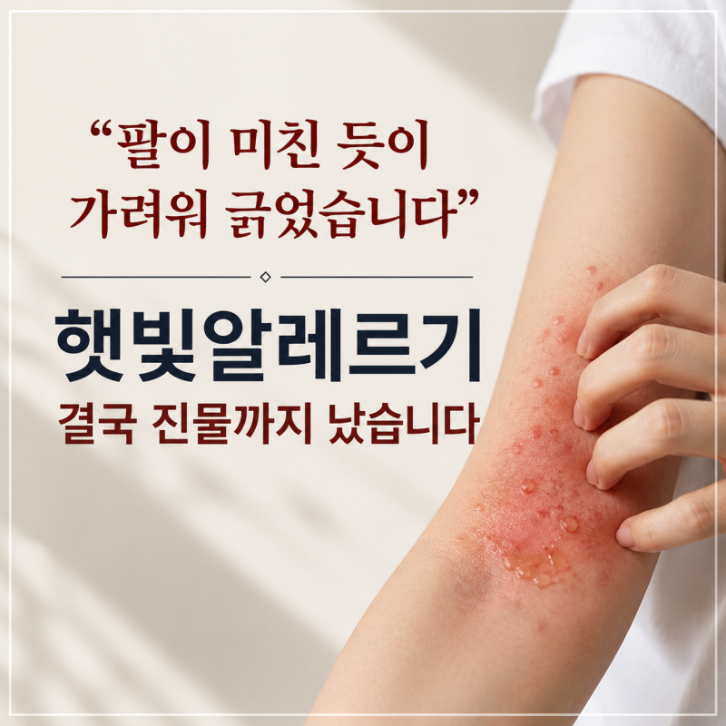 "팔이 미친 듯이 가려워 긁었습니다" 햇빛알레르기 결국 진물까지 났습니다