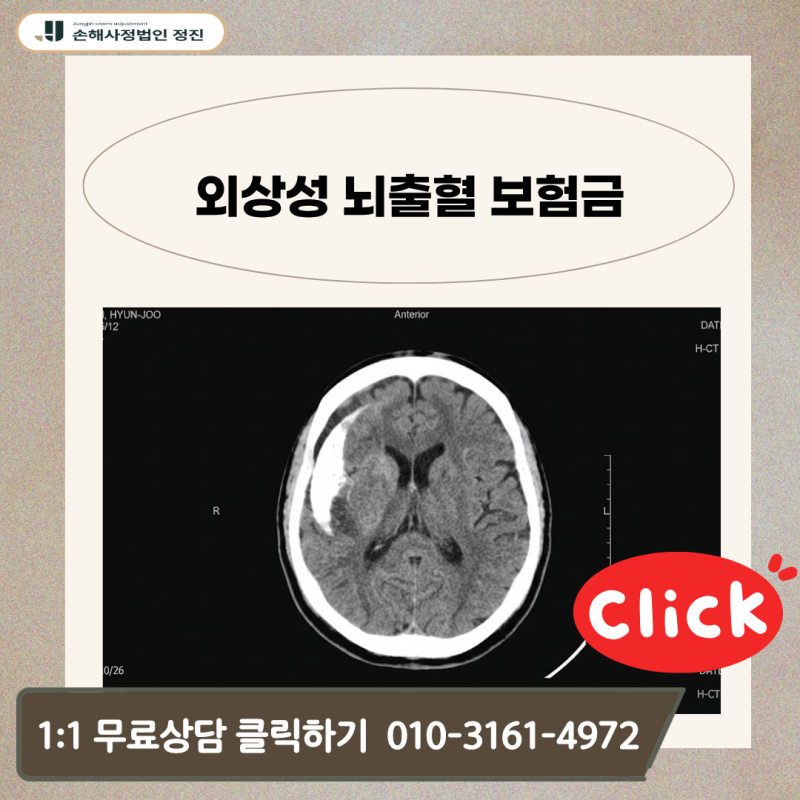 외상성 뇌출혈 보험금 S06 진단받고도 지급 거절당했다면? 손해사정사가 밝히는 3가지 반전 ....