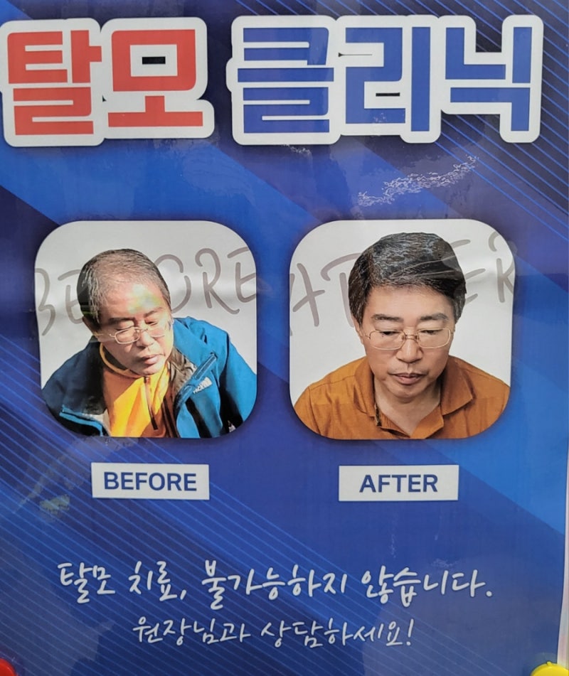 [병원리뷰]부산 망미동 탈모성지 내과병원 처방약종류|작용기전|효과있는 이유 정리