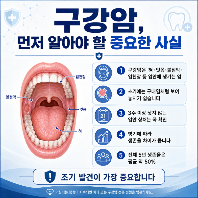 구강암 생존율은? 1기·2기·3기·4기 분석 총정리