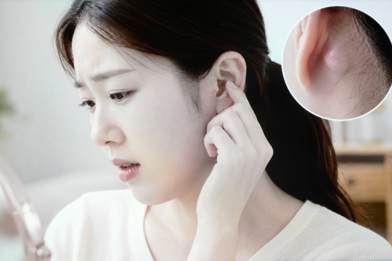 귀뒤 멍울 피지낭종 원인, 그냥 두면 괜찮을까요?