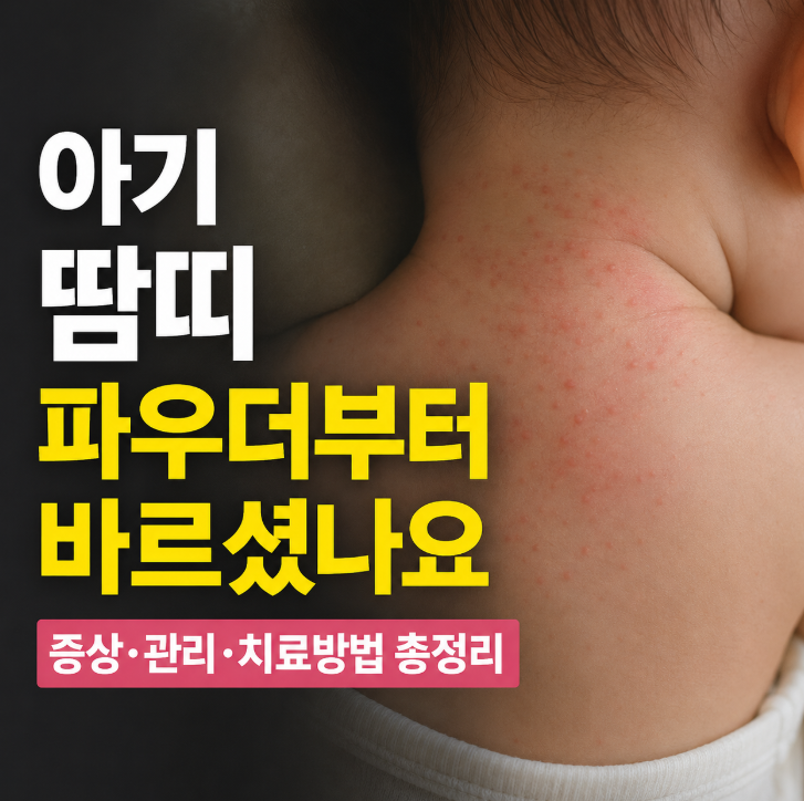 아기 땀띠, 파우더부터 바르셨나요? 증상·관리·치료방법 총정리