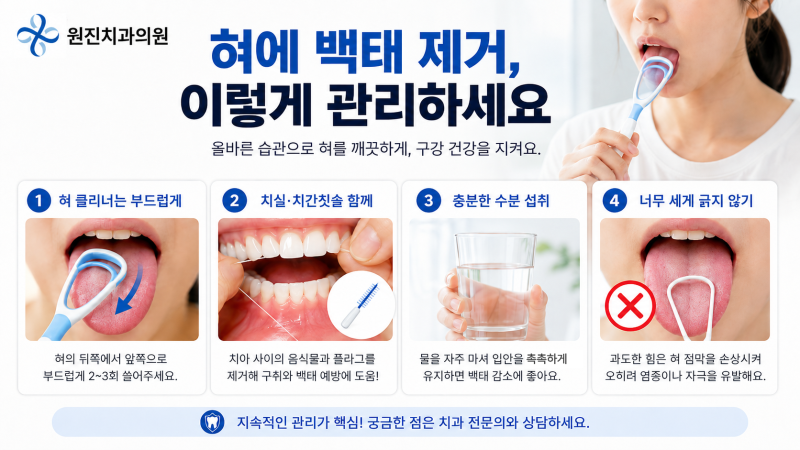 혀에 백태, 닦아도 자꾸 생기는 원인과 제거 방법은?