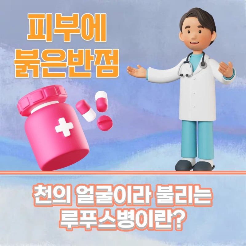 면역 이상으로 생기는 루푸스병 증상과 특징
