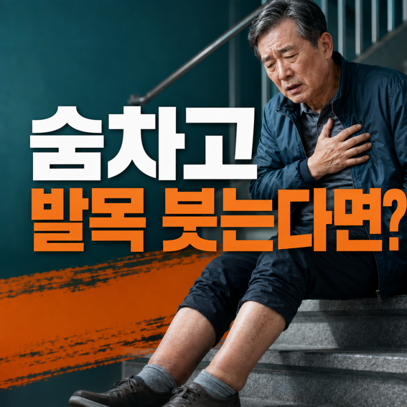 심부전초기증상, 계단 두 층에 숨차고 양말 자국이 깊다면…나이 탓이 아닐수도 있어요
