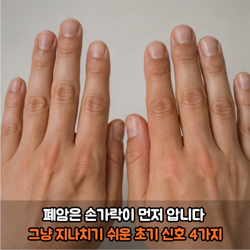 "폐암은 손가락이 먼저 압니다..." 그냥 지나치기 쉬운 초기 신호 4가지