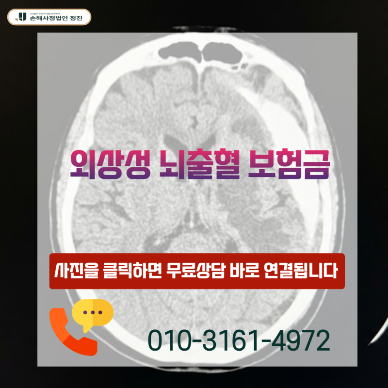 외상성 뇌출혈 보험금, S06 진단에도 부지급 통보를 받으셨나요?
