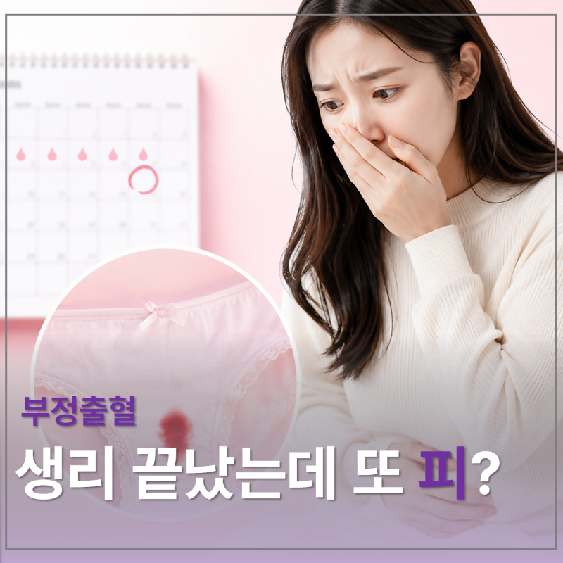 부정출혈 원인, 생리 아닌데 피가 나는 이유 5가지
