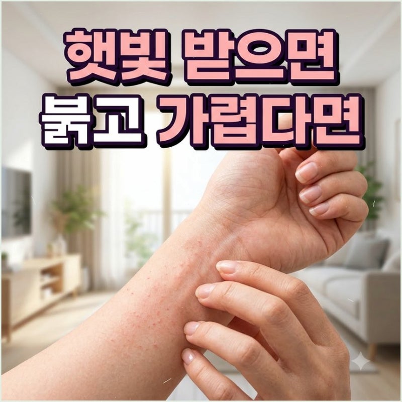 햇빛 알레르기 증상 원인과 예방 관리법 외출 전 자외선 차단제 바르게 바르는 방법