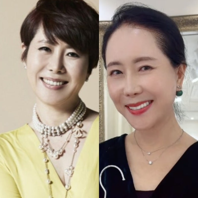 "누구세요?" 10kg 감량에 안면거상·모발이식까지… 싹 갈아엎고 나타난 윤영미의 파격 행보