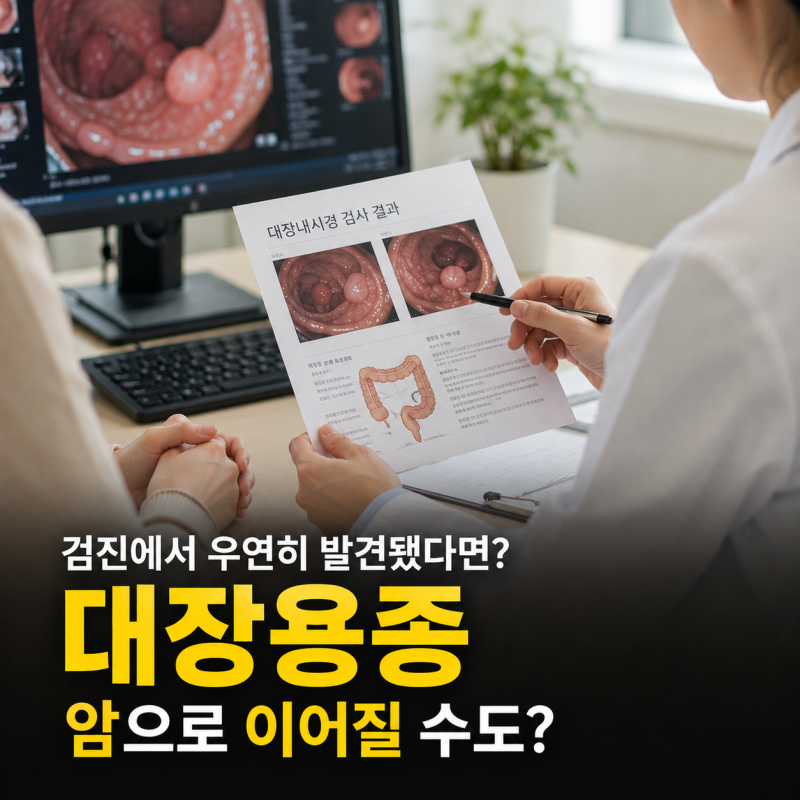 대장용종 원인 증상 발견되면 제거해야하는 용종 종류