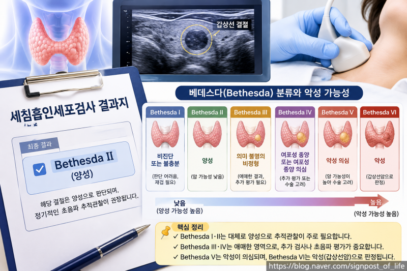 갑상선암 시리즈 3편 갑상선 세침검사 결과 보는 법｜베데스다 1~6단계, 암 가능성은?