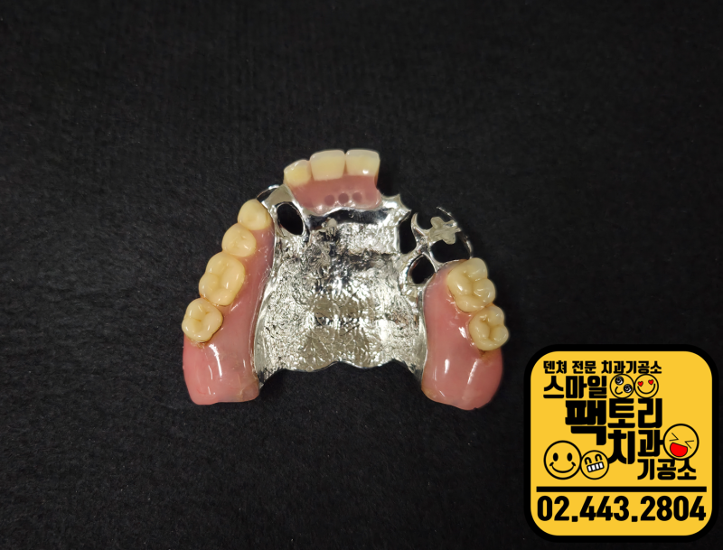 덴쳐 리페어 틀니 수리, 제대로 수리하려면 이렇게. 2부-인공 치아 및 레진상 수리. Denture Repai....