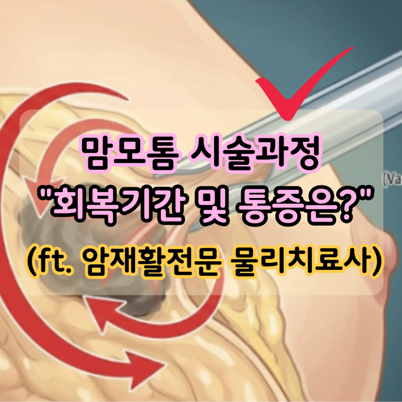 "맘모톰 회복기간과 통증은?" 맘모톰시술 과정 4단계 정리 (ft. 암재활전문 물리치료사)