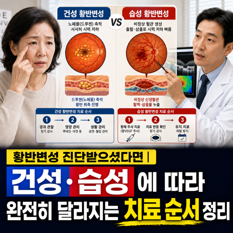 황반변성 진단받으셨다면｜건성·습성에 따라 완전히 달라지는 치료 순서 정리