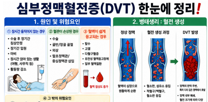[성인간호학] 91. 심부정맥혈전증(DVT)