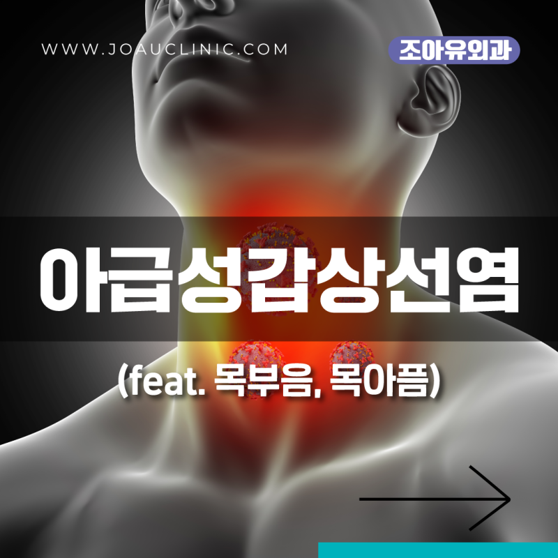 갑상선 목통증 감기후 목이 아프다면 아급성 갑상선염 의심