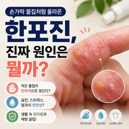 손가락 물집처럼 올라온 한포진, 진짜 원인은 뭘까?