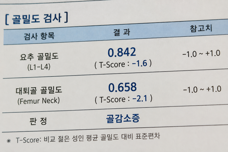 국가검진 골밀도 결과지 속 T-score 수치 해석과 골다공증 대비법