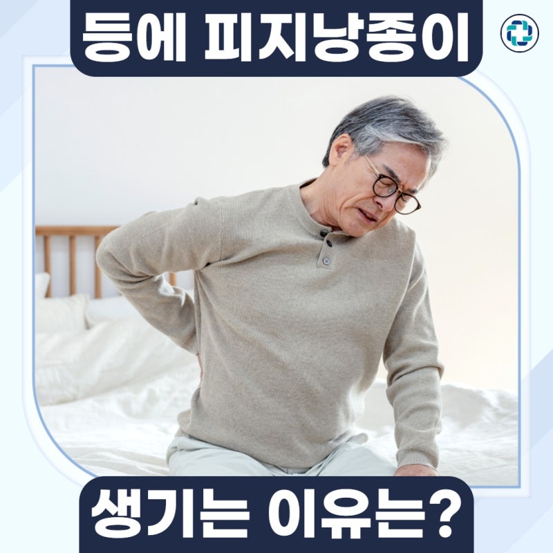 등 피지낭종 제거, 언제 필요하고 어떻게 관리할까?