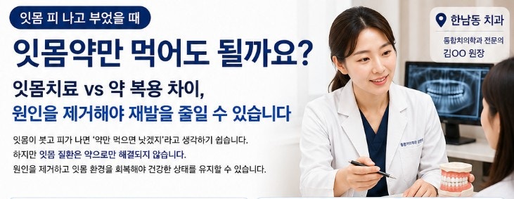 잇몸 피나고 부었을 때 잇몸약만 먹어도 될까요? 잇몸치료 vs 약 복용 차이, 한남동 잇몸치료 ....