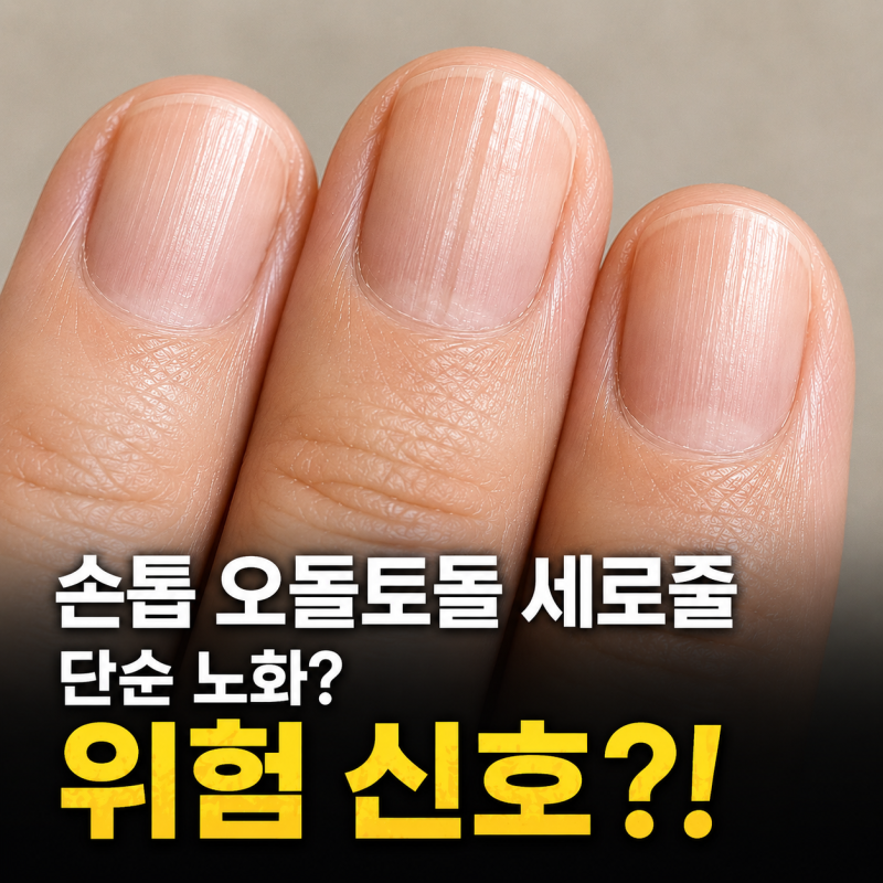 손톱 세로줄 생기는 이유… 단순 노화일까, 몸이 보내는 신호일까?