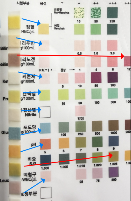 소변스틱 검사) 방탄 커피먹어도 케톤은 안오름 !