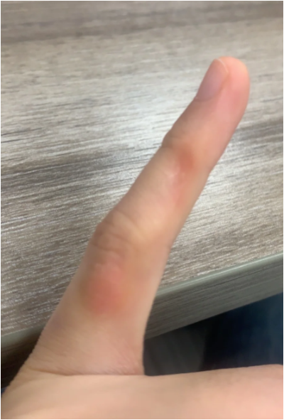 손굳은살제거 각질제거기 세 개 갈아치우고 정착한 하나