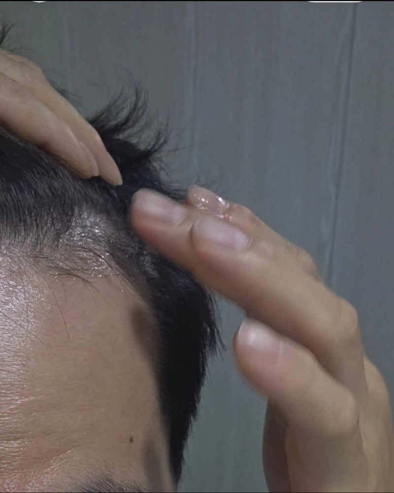 마이녹실 5% 폼형 바르는 법 로게인폼 똑같음