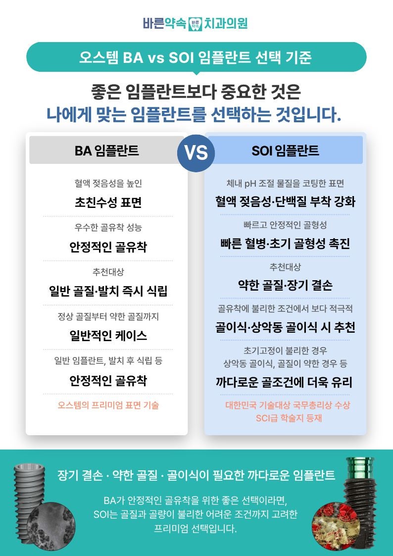 부천역 임플란트 ::오스템 ba/soi 차이