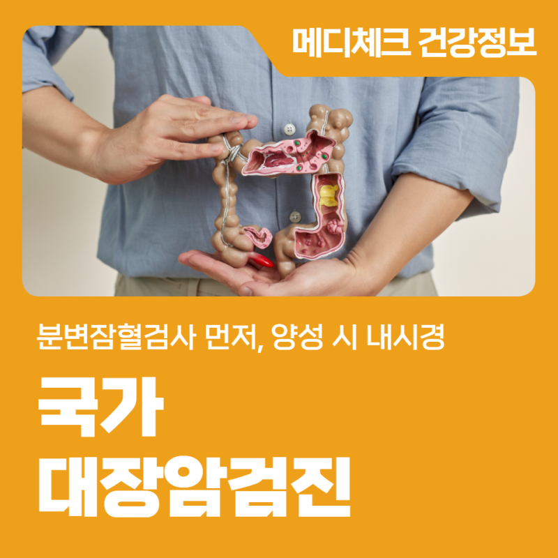 수원암검진 대장암 분변잠혈검사 먼저, 양성 시 내시경