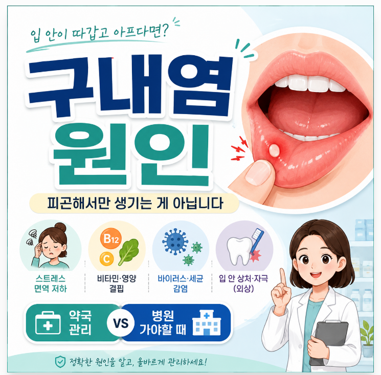 구내염 원인, 단순히 피곤해서 생기는 걸까? 병원 가야 하는 구내염까지 정리