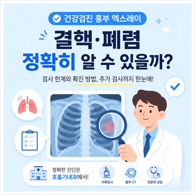 건강검진 흉부 엑스레이로 결핵이나 폐렴 확실히 찾을 수 있나요? 검사 한계와 확진 방법